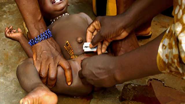kvinnlig-könsstympning-847663